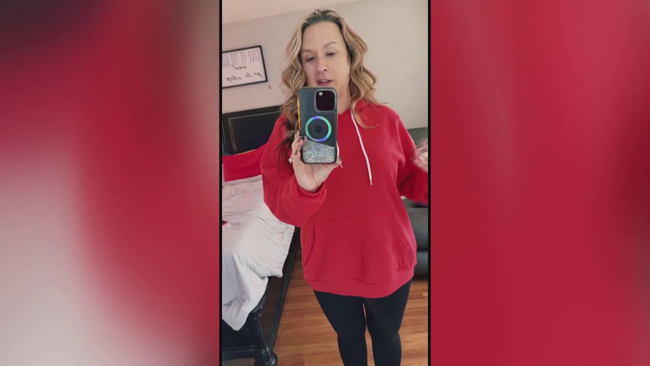 عملية شد بطن تتحول إلى مأساة.. وحقيقة عمليات تجميل عائشة كاي