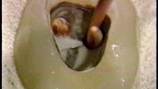 12 1 Endodontic Instruments