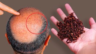 Hair grows like crazy and doesn't fall out, it's a powerful tool! Strongest ingredient