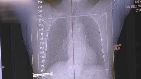 레지오넬라증 58% 증가…만성질환자 주의 / YTN 사이언스