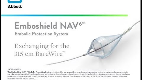 Exchanging for the 315 cm BareWire™ | Emboshield NAV6™ Embolic Protection System