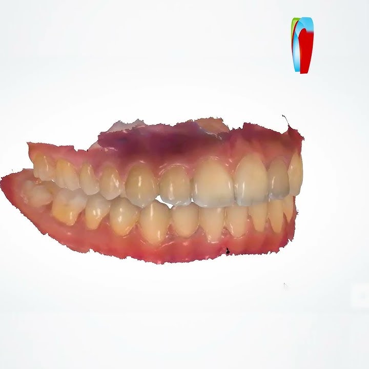 Medit i700