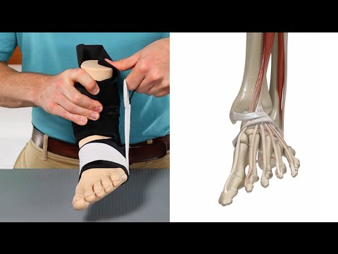 Lateral Ankle Sprains -  Treatment and Prevention