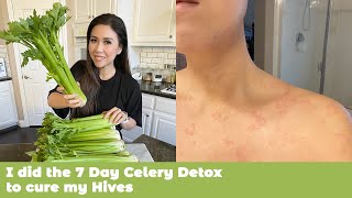 I did the 7 Day Celery Detox to cure my Hives | MyHealthyDish by MyHealthyDish 66,502 views 3 years ago 12 minutes, 26 seconds