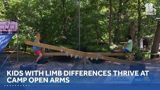Kids with limb differences thrive at Camp Open Arms