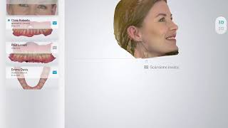 3Shape Communicate on IOS (iPad)