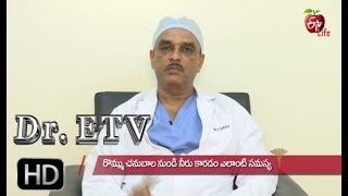 Cause For Breast Discharge Dr Etv 7Th August 2019 Etv Life