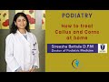 Callus and Corn Treatment at Home - Sanela Care - Dr. Sireesha Battula