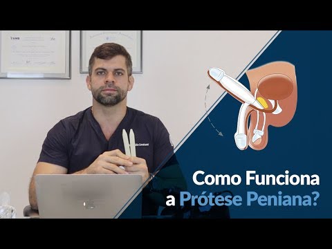 Como Funciona a Prótese Peniana? - Dr Marco Túlio Cavalcanti