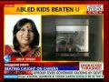 Disabled child beaten mercilessly teacher