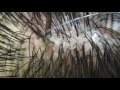 フケ【part58】dandruff