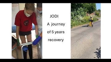 Jodi - a 5 year journey of recovery