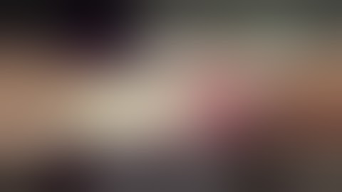 TA tendon reconstruction by V-Y plasty & FHL tendon transfer # Dr Abdullah  Al Rafi