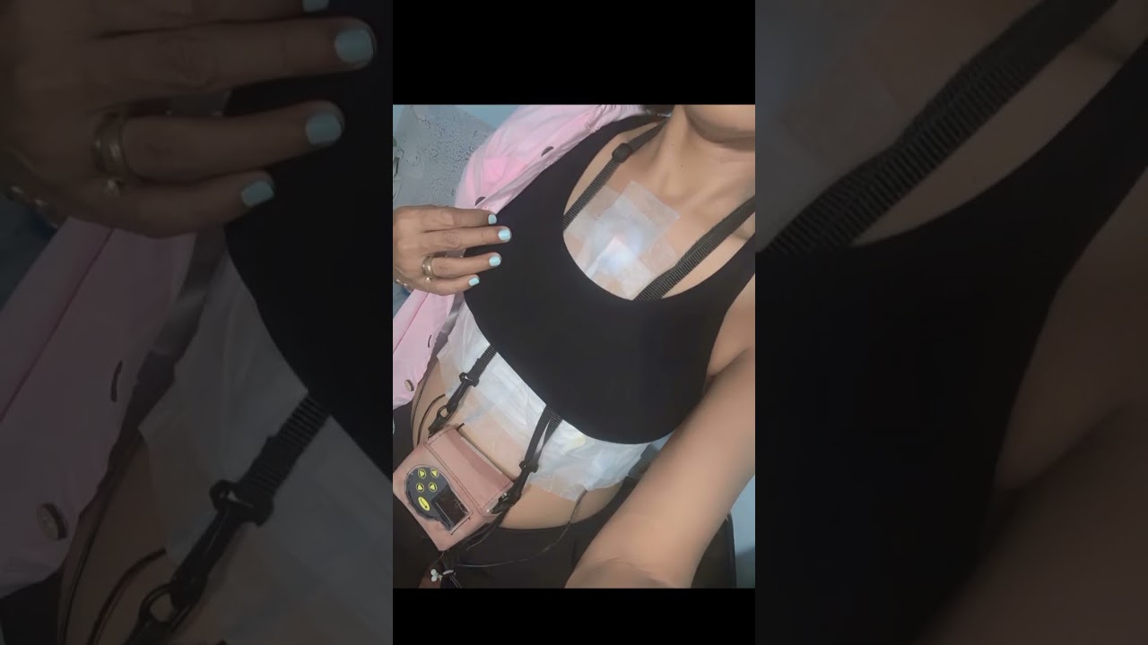 24 Hour Holter Monitor 