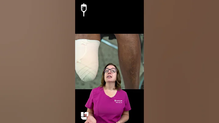 Nursing care of patient after amputation: Medical Surgical SHORT | @LevelUpRN