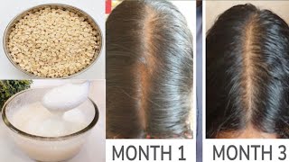 Extreme Hair Growth Urad Dal Hair Mask to get rid of HairFall, Split Ends, Dandruff &amp; Damaged Hair