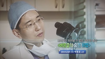 비문증의 숨은 위협 - 경북대학교병원 안과 박동호 교수 - 1