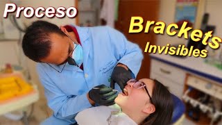 Un Dia En El Dentista Brackets Michelle Decont