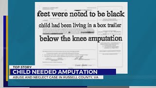 Court docs: Russell Co. child had part of leg amputated after being kept in trailer for months