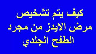 كيف يتم تشخيص مرض نقص المناعة البشري من مجرد الطفح الجلدي