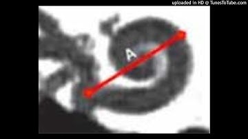 Measuring cochlear duct length