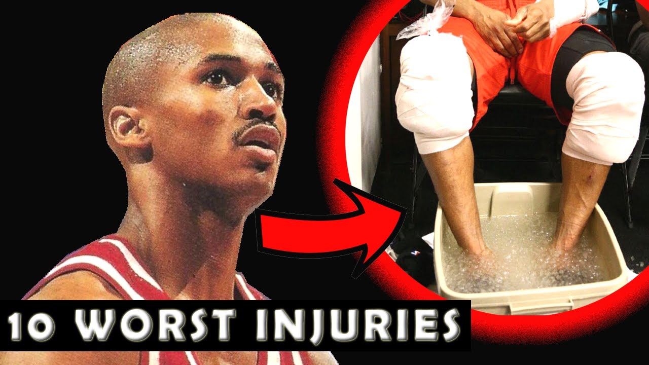10 Most Gruesome Injuries in NBA History - YouTube