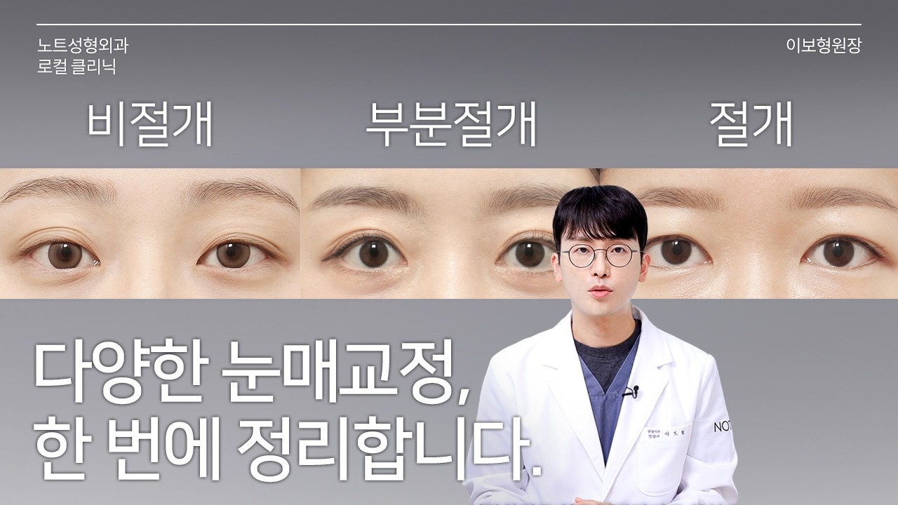 [이보형 원장의 Q&A] 그래서 저는 뭘 해야 하는데요 l 눈매교정 총정리 l 눈매교정 전후 l