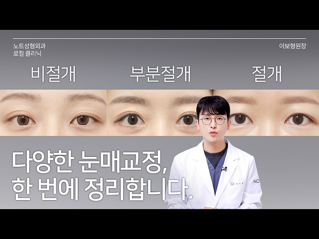 [이보형 원장의 Q&A] 그래서 저는 뭘 해야 하는데요 l 눈매교정 총정리 l 눈매교정 전후 l