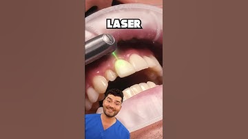 Dental Laser Explained !?