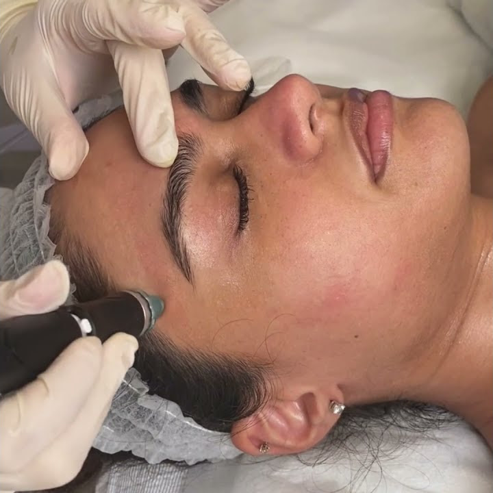 HydraFacial Treatment in Dubai | Best Hydra Facial Dubai, UAE - YouTube