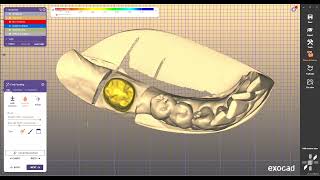 download install millbox all dental milling machine
