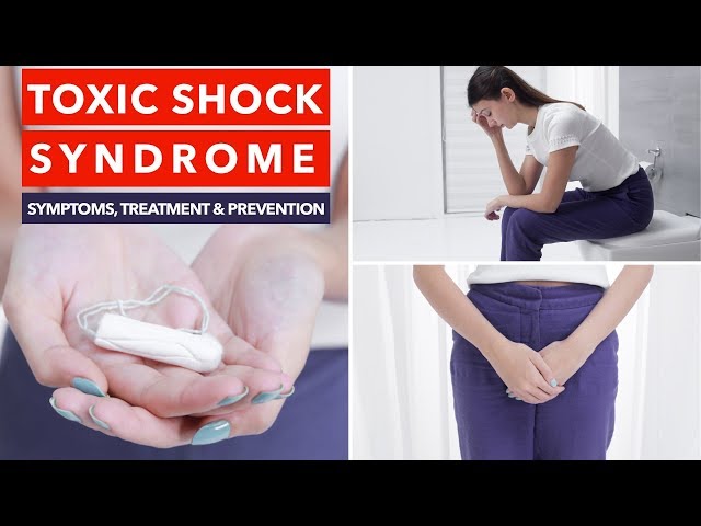 Toxic shock syndrome: Causes, symptoms, and prevention