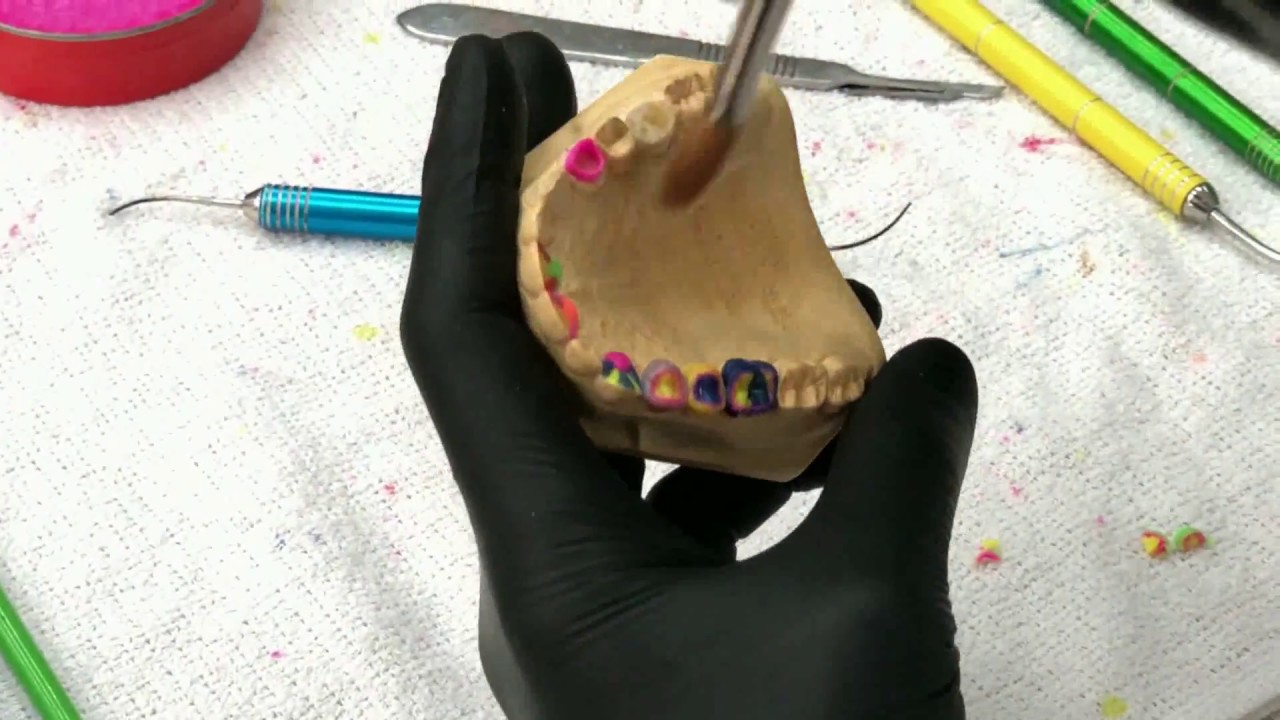 ENCERADO PRIMER PREMOLAR SUPERIOR