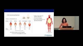 Update in Myasthenia Gravis