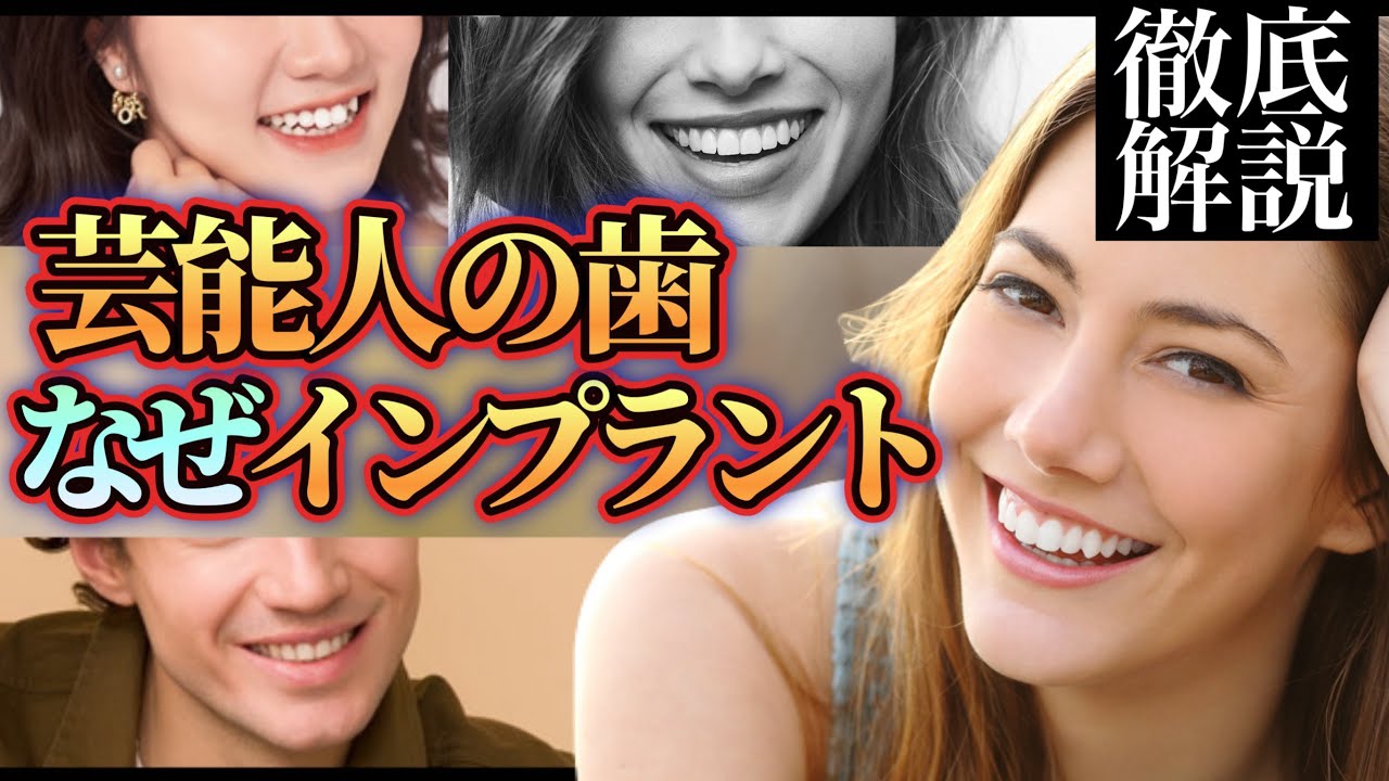 インプラント 失敗 芸能人