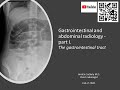 Iii radiology lecture  abdominal and git radiology  the gastrointestinal track