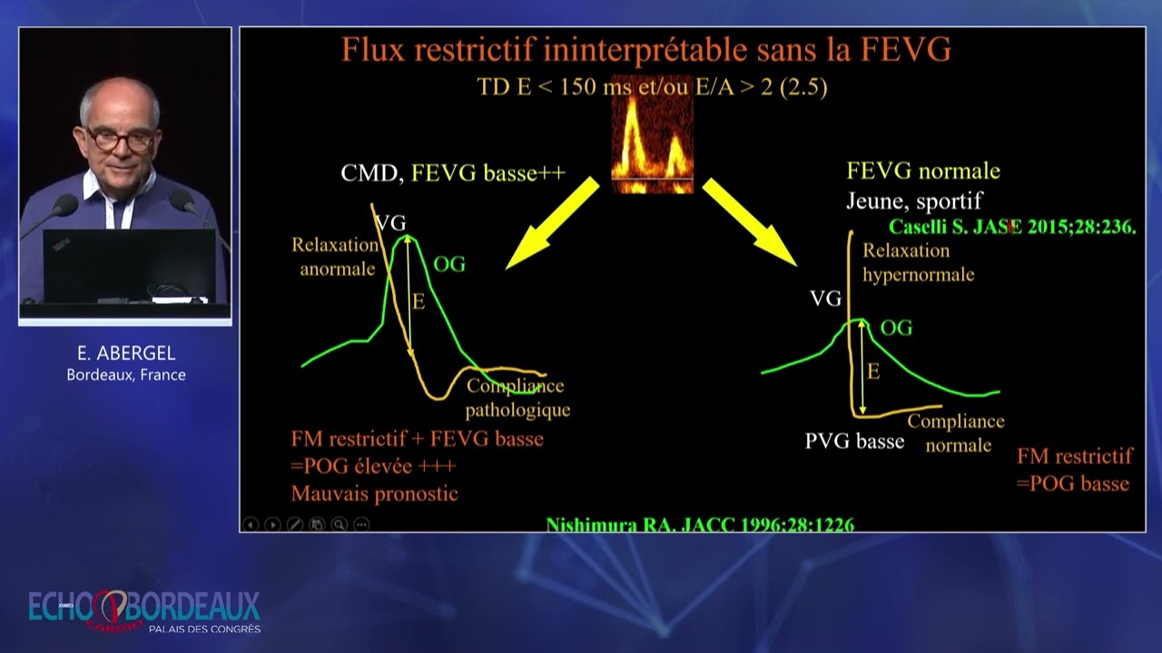 Les pièges dans l’estimation des pressions de remplissage : algorithme pratique et raisonné