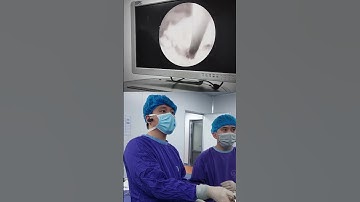 Hình ảnh nội soi rách chóp xoay khớp vai #chanthuongchinhhinh #bacsithoan