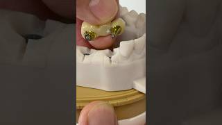 Screw-Retained Zirconia for Dr. Olga Krikunenko in Massachusetts