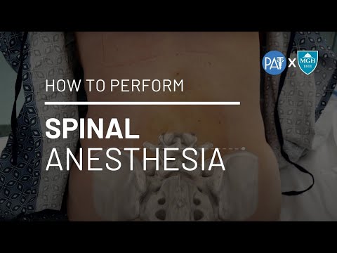 Video: Kaip atlikti spinalinę anesteziją?