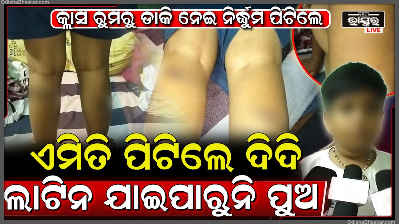 ଗଣିତ ପାଠ କଲେନି ବୋଲି ଶିକ୍ଷୟତ୍ରୀ ଦେଲେ ଏମିତି ଦଣ୍ଡ...ମେଡିକାଲରେ ଭର୍ତ୍ତି ହେଲେ ଛାତ୍ର...