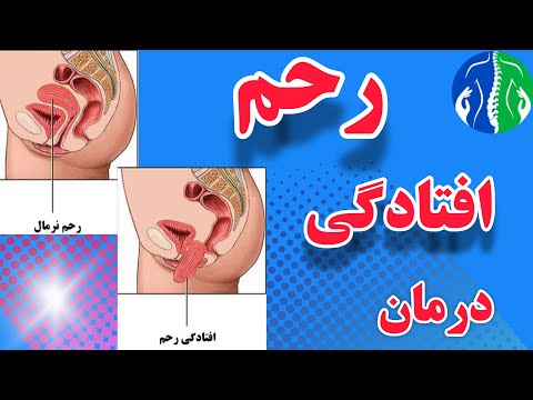 تصویری: 3 راه مقابله با پریود شدن در سنین بسیار پایین