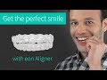 Before and After eon Aligners: Joseph's Orthodontic Case | Eon Aligner