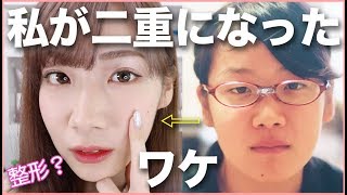ガンコな一重から二重になった理由 Youtube ガンコな一重から二重になった理由 Youtube