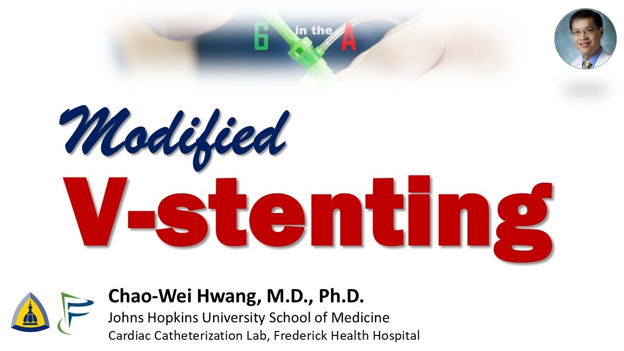 Модифицированное V-образное стентирование при одновременных поражениях устья.