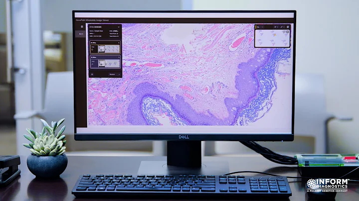 What is Digital Pathology for Dermatologists All About?