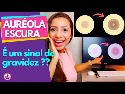 Vídeo: O que é uma auréola de contato?