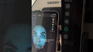 OBSERV® 520x: Elevate Your Clinic’s Skin Consultations | DermaSpark