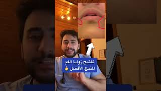 المنتج الأفضل لتفتيح زوايا الفم | دكتور يوسف