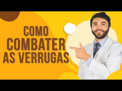 Como combater as Verrugas | Dr Lucas Fustinoni - Médico - CRMPR: 30155